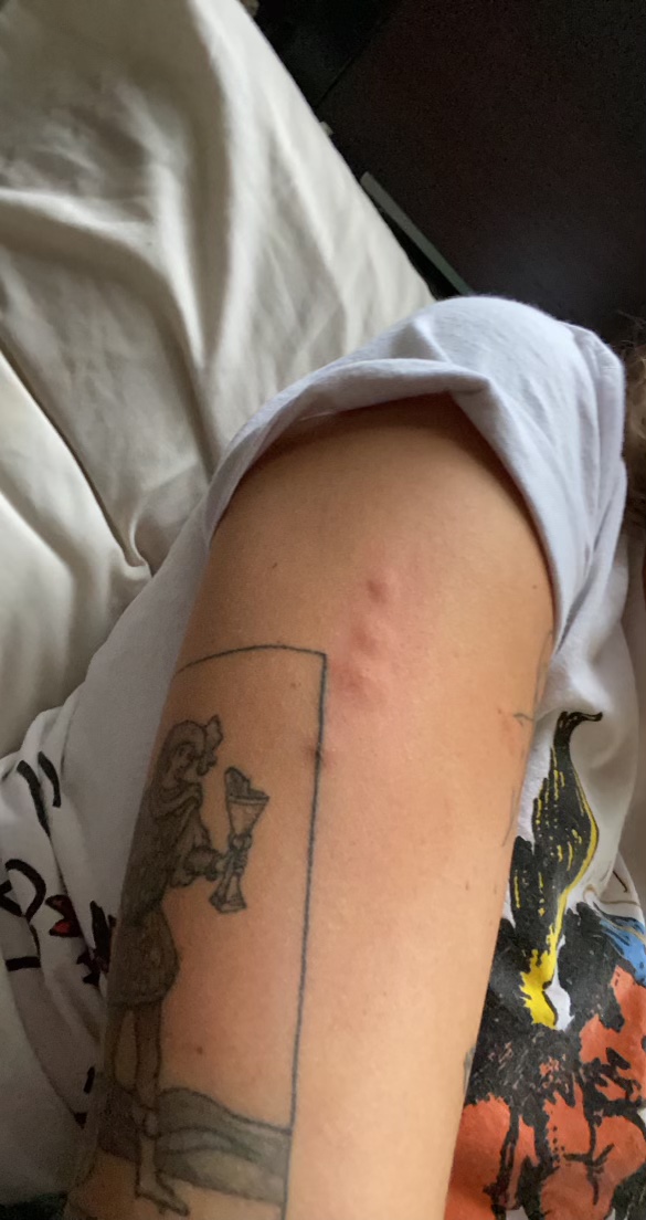 South beach casino manitoba bed bugs South beach casino manitoba bed bugs